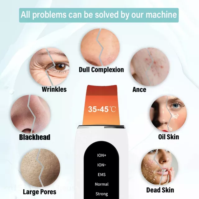 Ultrasonic Skin Scrubber: Deep Pore Cleanser & Blackhead Remover - Image 3