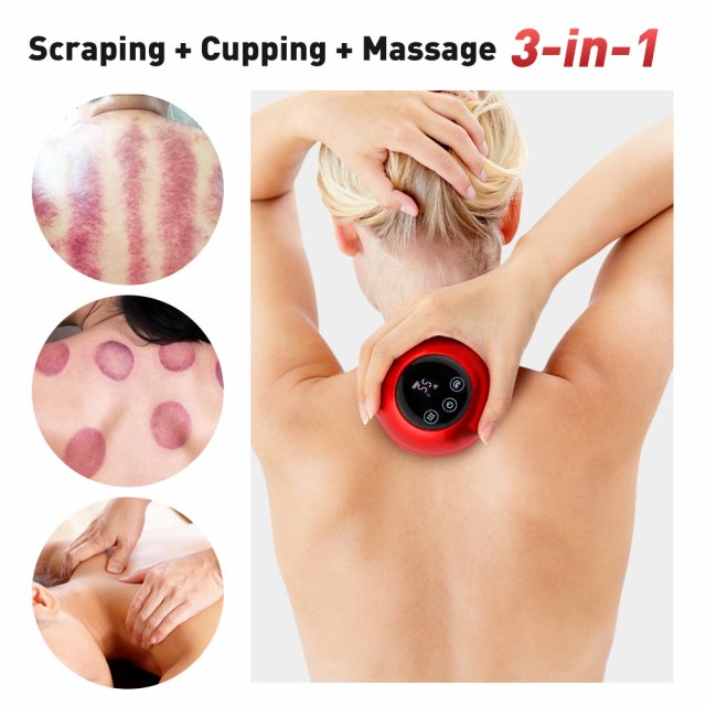 Electric Cupping Massage Device – Vacuum Suction & Scraping Therapy - Image 3