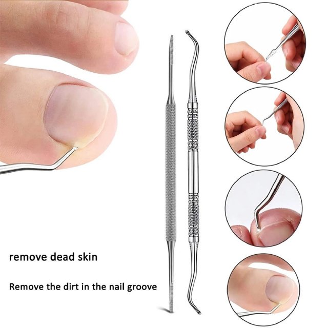 Professional Ingrown Toenail Treatment Set with Correction Patches and Pedicure Tools - Image 6