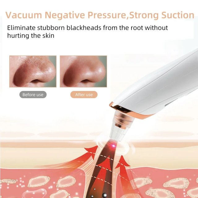 Electric Pore Vacuum Cleaner with LED Display - Image 5