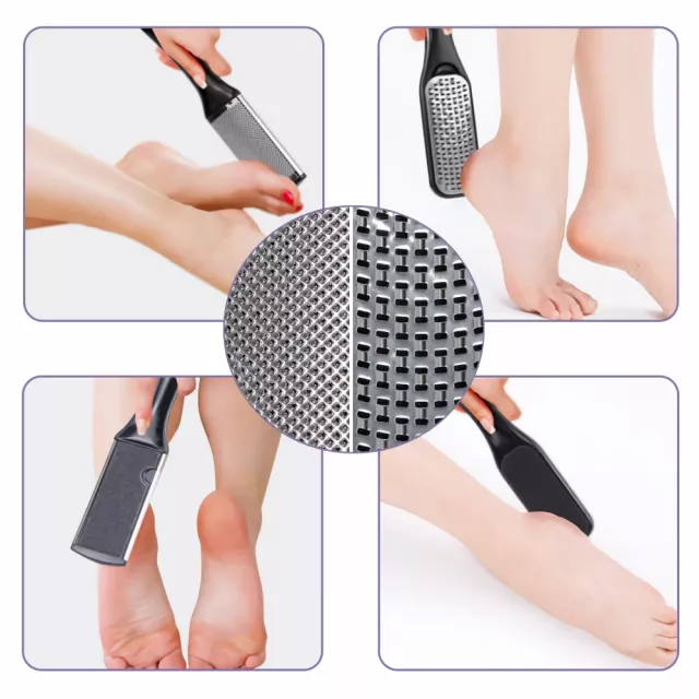 10-in-1 Pedicure Set: Exfoliating Foot Scrubber & Callus Remover - Image 3