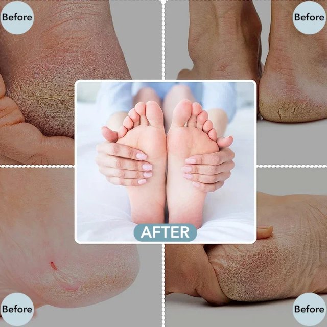 Stainless Steel Double-Sided Foot File - Image 6