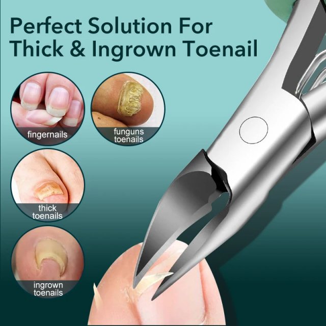 Precision Ingrown Toenail Clippers for Thick and Curly Nails - Image 5