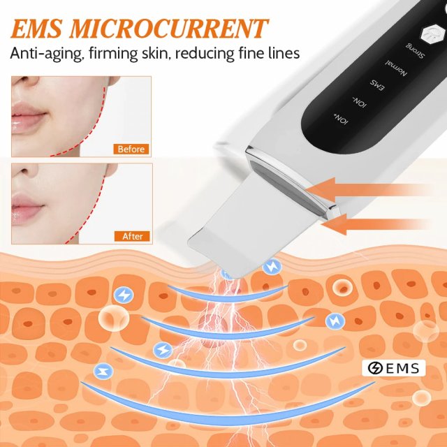 Ultrasonic Skin Scrubber - Image 4