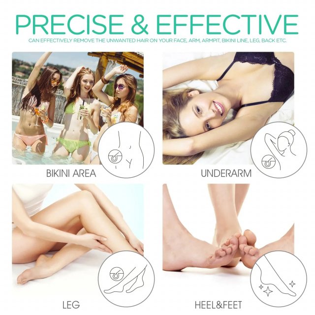 Rechargeable 3-in-1 Epilator & Callus Remover for Women - Image 6