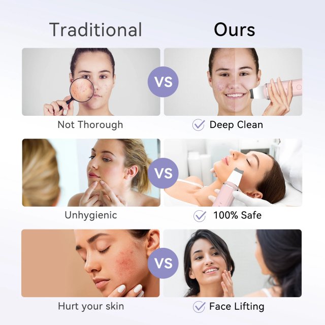 Ultrasonic Skin Scrubber & EMS Lifting Tool - Image 6