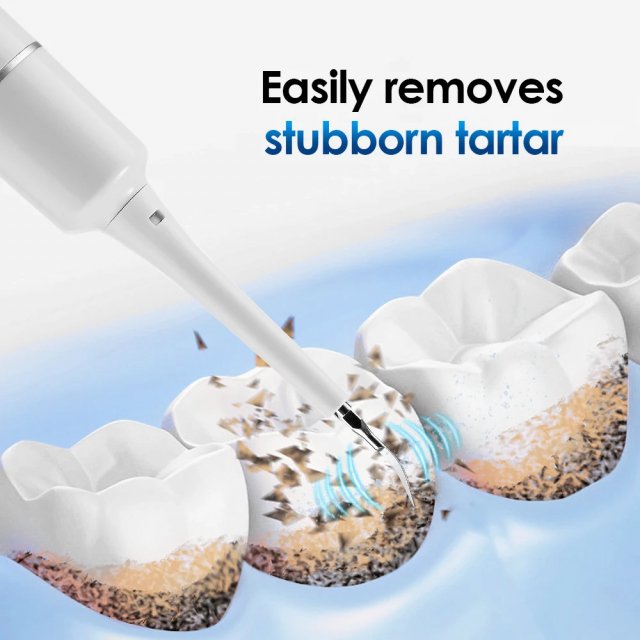 Electric Sonic Vibration Tooth Cleaner – Plaque and Tartar Remover - Image 6