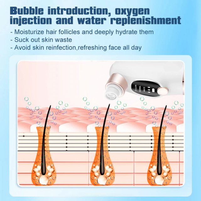 Electric Pore Vacuum and Face Cleaner - Image 4