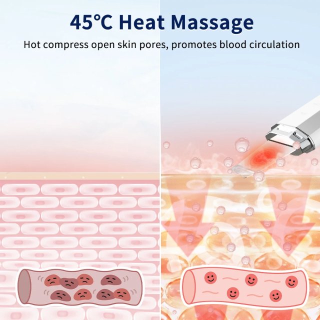 Ultrasonic Skin Scrubber with Ion Deep Cleansing and EMS Facial Lifting - Image 3