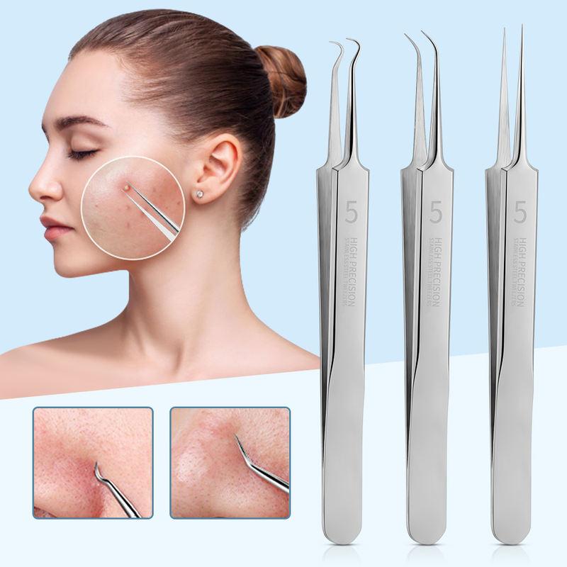 3-Piece Blackhead & Pimple Extractor Set - Stainless Steel Facial Care Tool