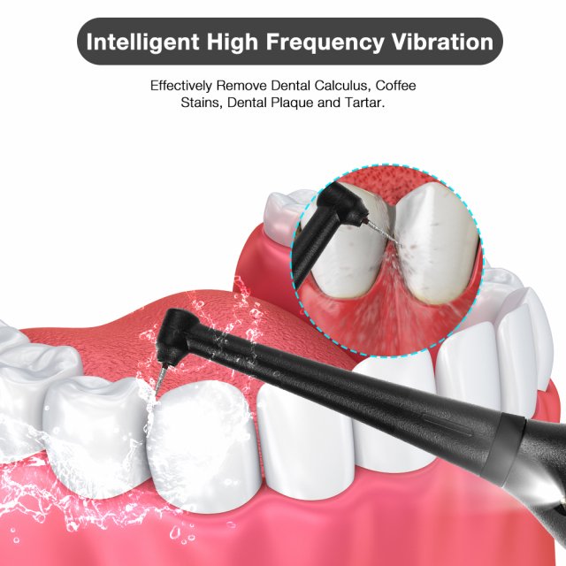 Electric Tartar Scraper & Dental Cleaning Scaler - Image 4