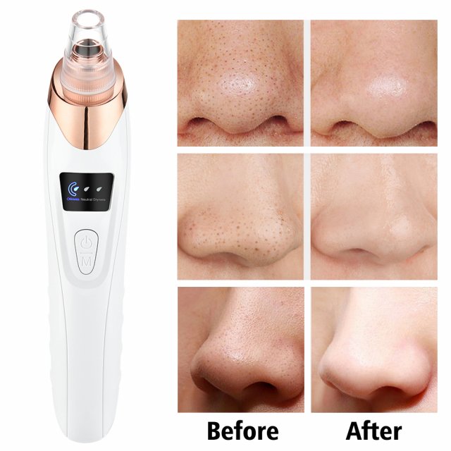 Electric Blackhead Remover Vacuum Cleaner with Deep Cleansing and Pore Extraction - Image 6