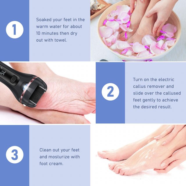 Rechargeable Electric Foot Callus Remover - Image 6