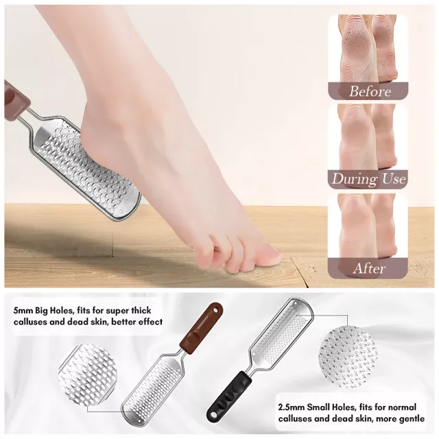 Professional Stainless Steel Foot File - Callus Remover for Dry, Rough Feet - Image 6