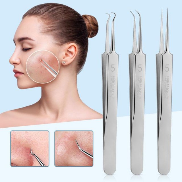 Stainless Steel Acne & Blackhead Removal Needles Set – Professional Skin Care Tool