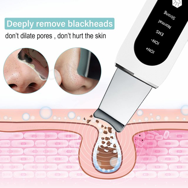 Ultrasonic Skin Scrubber & Blackhead Remover – Deep Pore Cleaner & Acne Treatment Facial Spatula - Image 5