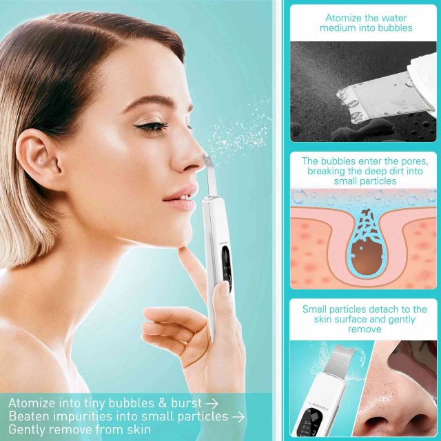 Ultrasonic Skin Scrubber Face Spatula – Deep Cleansing, Blackhead Remover & Skin Lifting Tool - Image 3